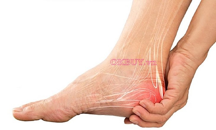 Gai gót chân là bệnh gì?